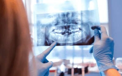 Are Dental X-Rays Safe?