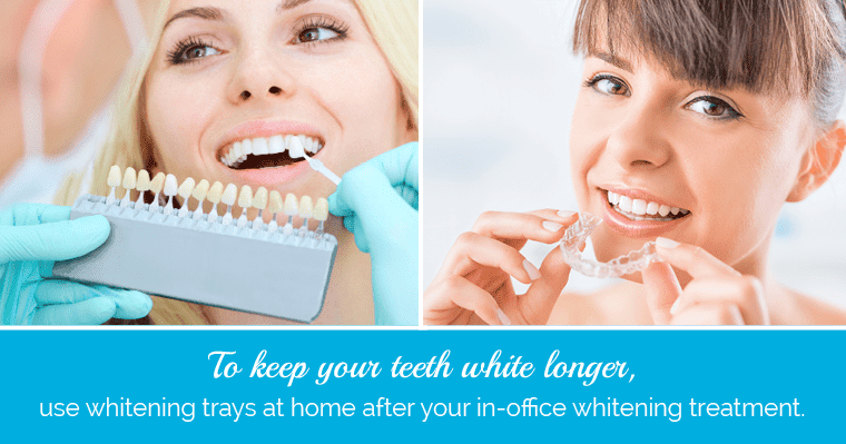 Image of a patient having professional whitening and a woman whitening her teeth at home Use a combination approach to keep your teeth white longer after whitening